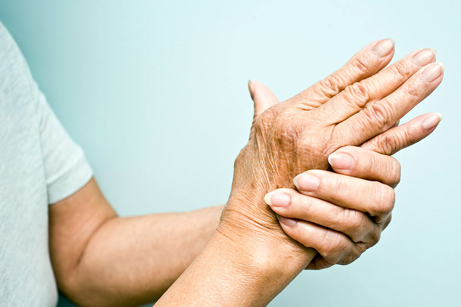 La artritis y su tratamiento con fisioterapia